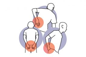 LOW BACK, BUTTOCKS, HIP PAIN<br>腰，下背部，臀部，髋部疼痛